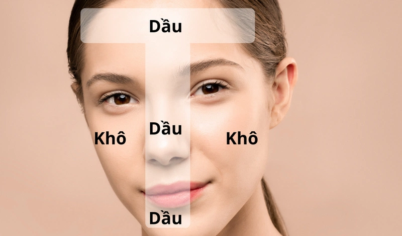 Đặc điểm của da hỗn hợp thiên dầu