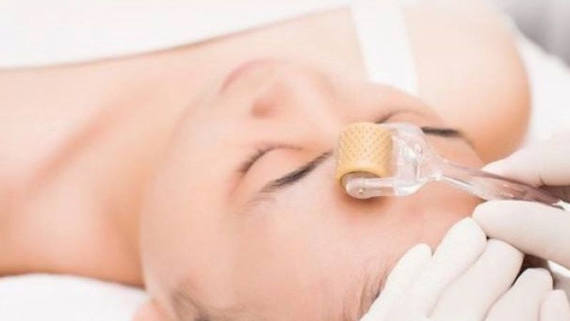 Thời gian nghỉ ngơi sau mỗi lần lăn kim quá ngắn