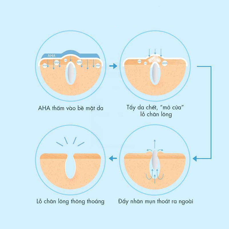 AHA có thể dễ dàng tan trong nước nên có tác dụng trên bề mặt da