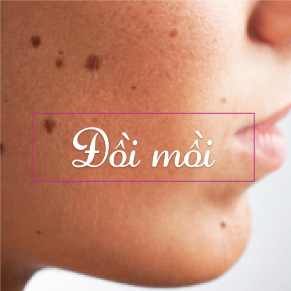 Cách đơn giản xóa đốm đồi mồi trên da tại nhà - Ảnh 1. Cách đơn giản xóa đốm đồi mồi trên da tại nhà - Ảnh 1.