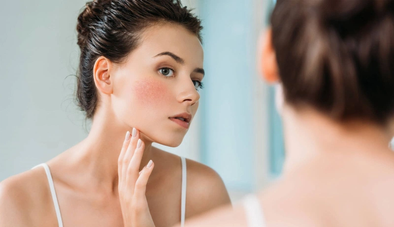 Có cần dùng kem chống nắng vào mùa đông không? 2