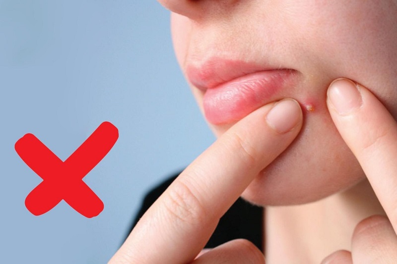 Bật mí những cách trị sẹo mụn hiệu quả nhất 2