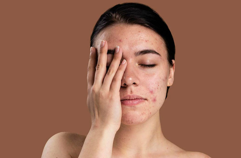 Cách chọn kem dưỡng ẩm cho da khô an toàn và hiệu quả 2