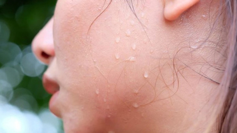 Mụn bọc là gì? Những điều bạn cần biết 1.jpg