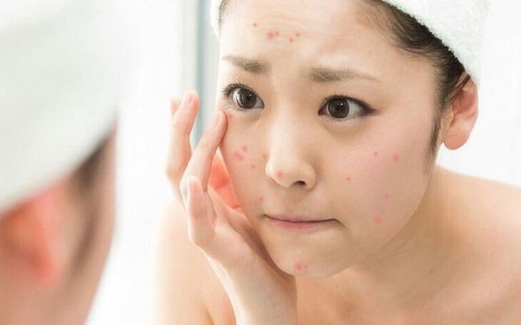 Da dễ bị dị ứng vào thời gian lúc 8 - 10 giờ tối Sử dụng quá nhiều dưỡng chất cùng một lúc vào 8 - 10 giờ tối khiến da dễ bị dị ứng