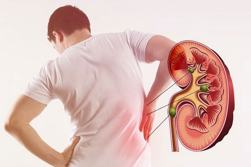 Các loại thực phẩm chống lão hóa cho nam giới cực hiệu quả 1