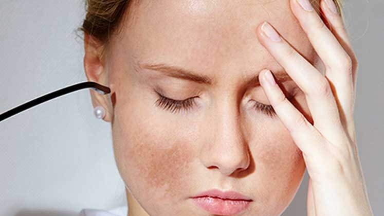 Cách chăm sóc da bị nám có thể bạn chưa biết 1