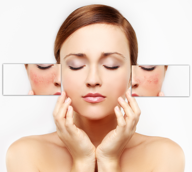 Rối loạn sắc tố melanin và những điều bạn nên biết 2