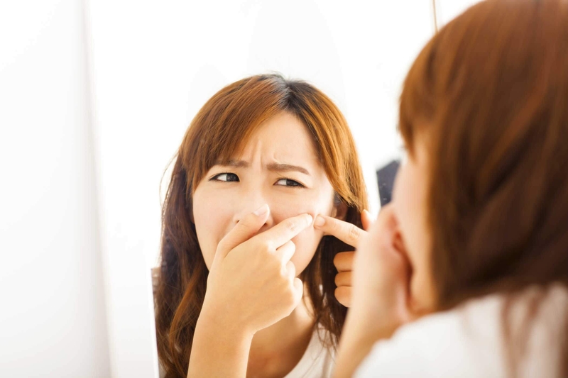 Có nên nặn mụn đầu đen hay không? Cách nặn mụn đầu đen không để lại sẹo tại nhà 1